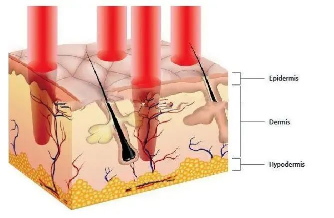 1770106494249465.jpg b5c1f1dd10819e8c3887b8b7fc91450a.jpg